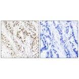 Immunohistochemistry - BRCA1 (Phospho-Ser1524) Antibody from Signalway Antibody (11117) - Antibodies.com