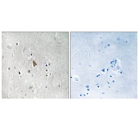 Immunohistochemistry - IGF1R (Phospho-Tyr1346) Antibody from Signalway Antibody (11716) - Antibodies.com