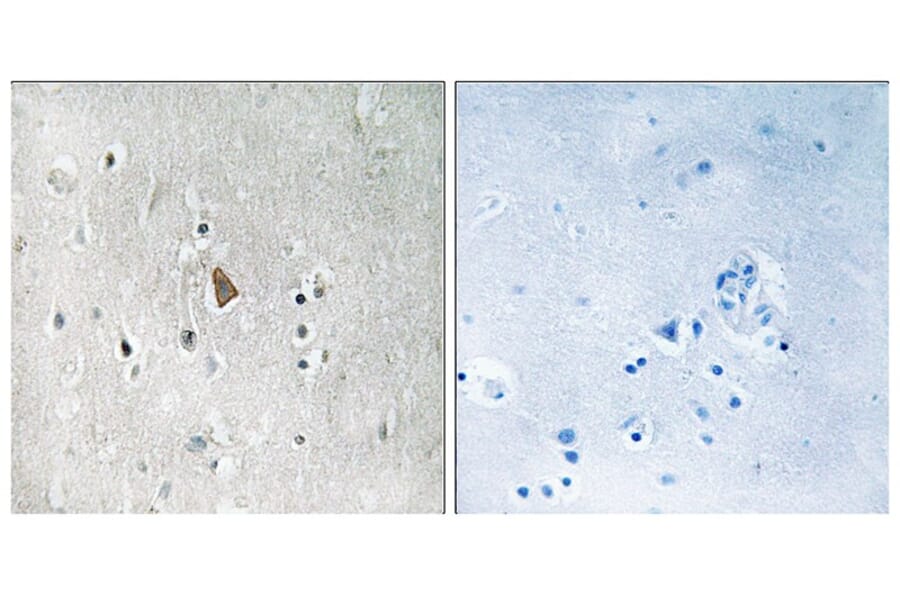 Immunohistochemistry - IGF1R (Phospho-Tyr1346) Antibody from Signalway Antibody (11716) - Antibodies.com