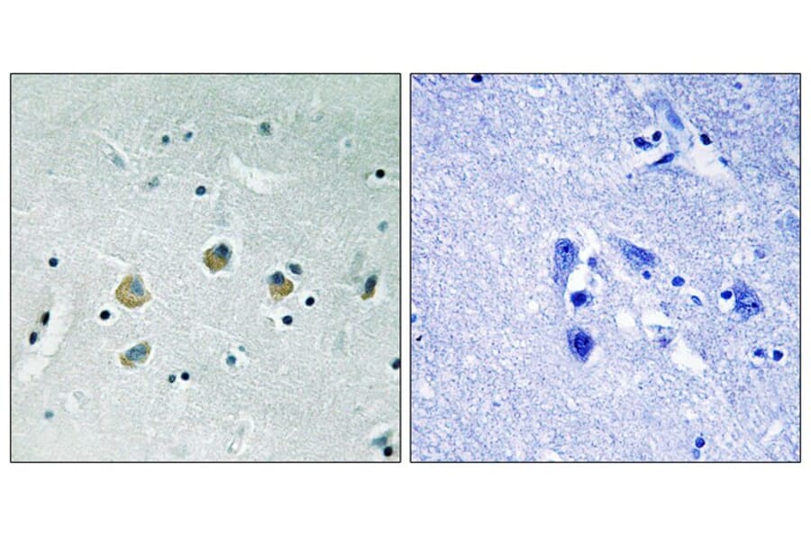 Immunohistochemistry - MAP3K8 (Phospho-Ser400) Antibody from Signalway Antibody (11739) - Antibodies.com
