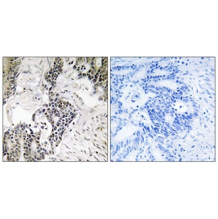 Immunohistochemistry - CDC25C (Phospho-Ser198) Antibody from Signalway Antibody (11790) - Antibodies.com