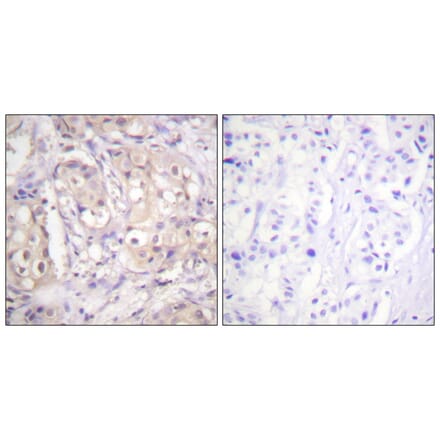 Immunohistochemistry - B-RAF (Phospho-Thr599) Antibody from Signalway Antibody (11682) - Antibodies.com