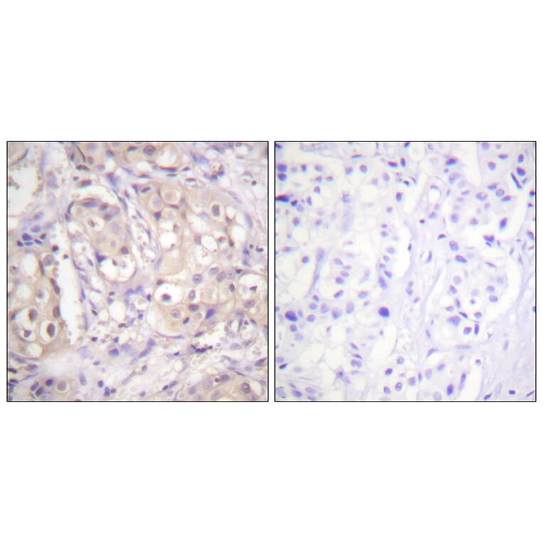 Immunohistochemistry - B-RAF (Phospho-Thr599) Antibody from Signalway Antibody (11682) - Antibodies.com