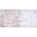 Immunohistochemistry - B-RAF (Phospho-Thr599) Antibody from Signalway Antibody (11682) - Antibodies.com
