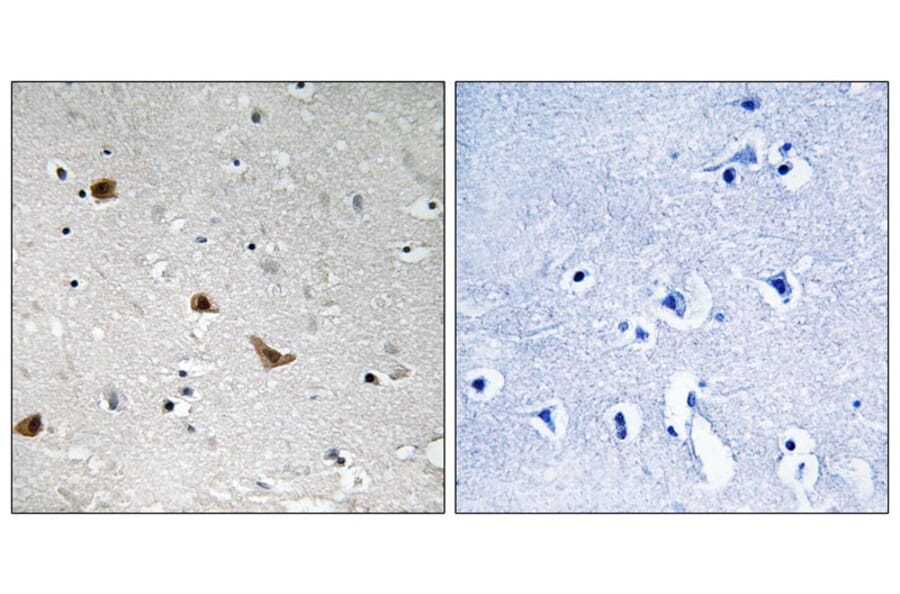 Immunohistochemistry - IKK-γ (Phospho-Ser376) Antibody from Signalway Antibody (11732) - Antibodies.com