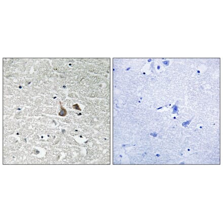 Immunohistochemistry - IRAK1 (Phospho-Ser376) Antibody from Signalway Antibody (11735) - Antibodies.com