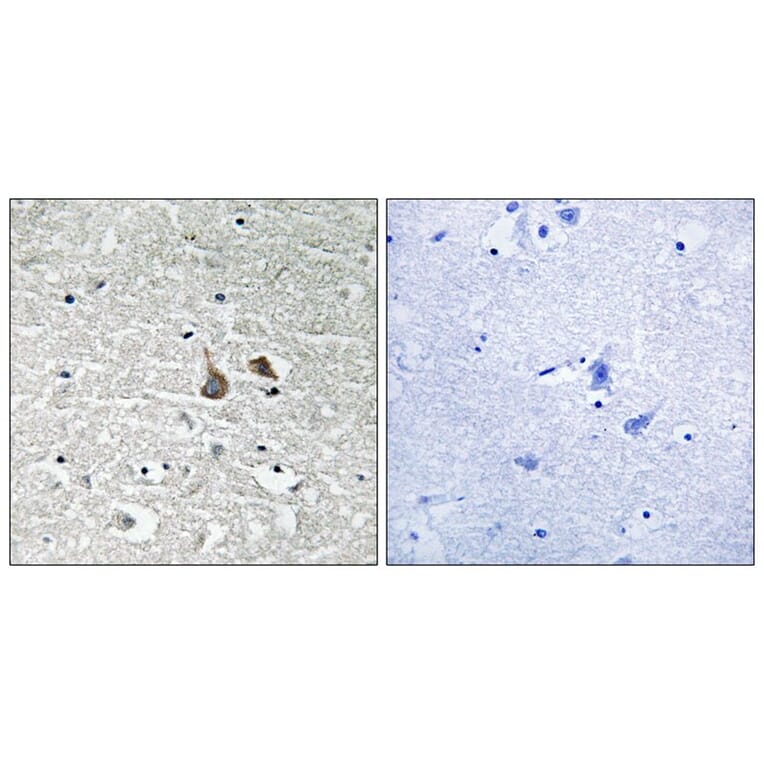 Immunohistochemistry - IRAK1 (Phospho-Ser376) Antibody from Signalway Antibody (11735) - Antibodies.com