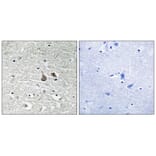 Immunohistochemistry - IRAK1 (Phospho-Ser376) Antibody from Signalway Antibody (11735) - Antibodies.com