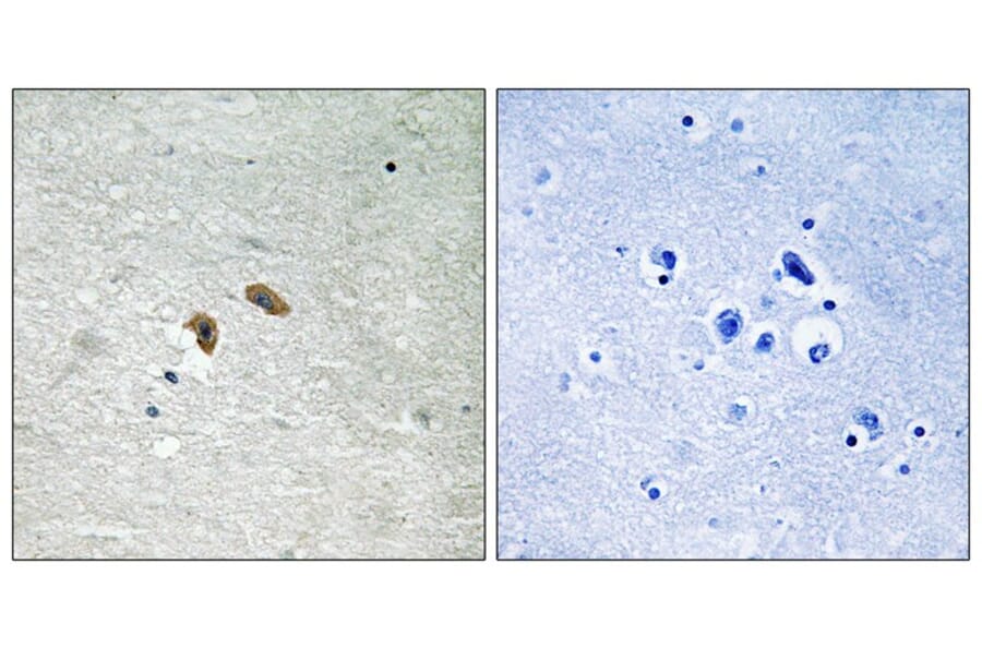 Immunohistochemistry - C-RAF (Phospho-Thr269) Antibody from Signalway Antibody (11752) - Antibodies.com