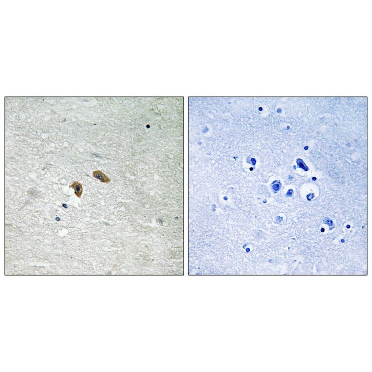 Immunohistochemistry - C-RAF (Phospho-Thr269) Antibody from Signalway Antibody (11752) - Antibodies.com