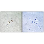 Immunohistochemistry - C-RAF (Phospho-Thr269) Antibody from Signalway Antibody (11752) - Antibodies.com