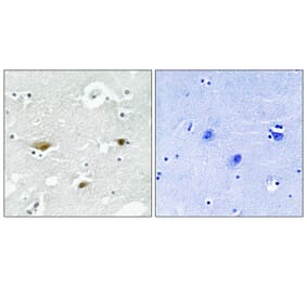 Immunohistochemistry - STK39 (Phospho-Ser323) Antibody from Signalway Antibody (11754) - Antibodies.com