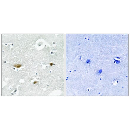 Immunohistochemistry - STK39 (Phospho-Ser323) Antibody from Signalway Antibody (11754) - Antibodies.com