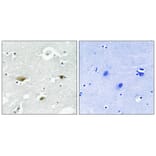 Immunohistochemistry - STK39 (Phospho-Ser323) Antibody from Signalway Antibody (11754) - Antibodies.com