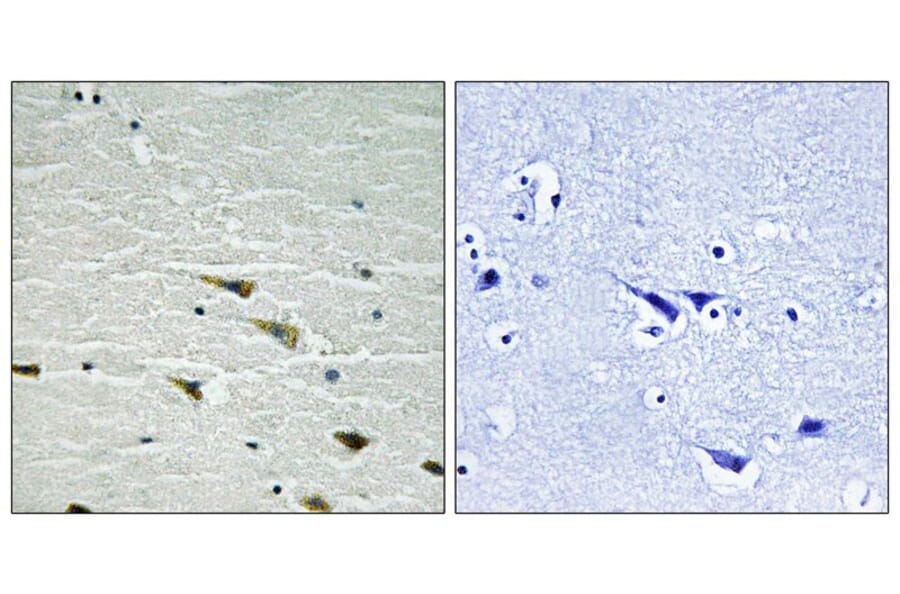 Immunohistochemistry - Trk A (Phospho-Tyr757) Antibody from Signalway Antibody (11757) - Antibodies.com