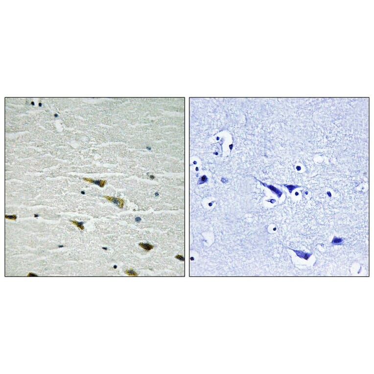 Immunohistochemistry - Trk A (Phospho-Tyr757) Antibody from Signalway Antibody (11757) - Antibodies.com