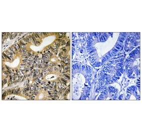 Immunohistochemistry - 4E-BP1 (Phospho-Thr70) Antibody from Signalway Antibody (11781) - Antibodies.com