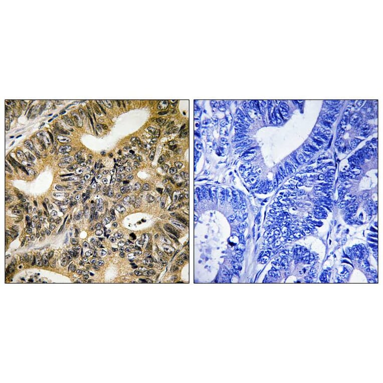 Immunohistochemistry - 4E-BP1 (Phospho-Thr70) Antibody from Signalway Antibody (11781) - Antibodies.com