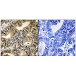 Immunohistochemistry - 4E-BP1 (Phospho-Thr70) Antibody from Signalway Antibody (11781) - Antibodies.com