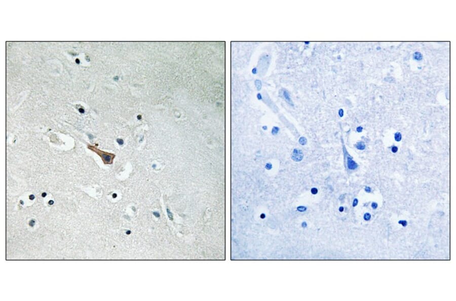 Immunohistochemistry - APLP2 (Phospho-Tyr755) Antibody from Signalway Antibody (11784) - Antibodies.com