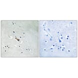 Immunohistochemistry - APLP2 (Phospho-Tyr755) Antibody from Signalway Antibody (11784) - Antibodies.com