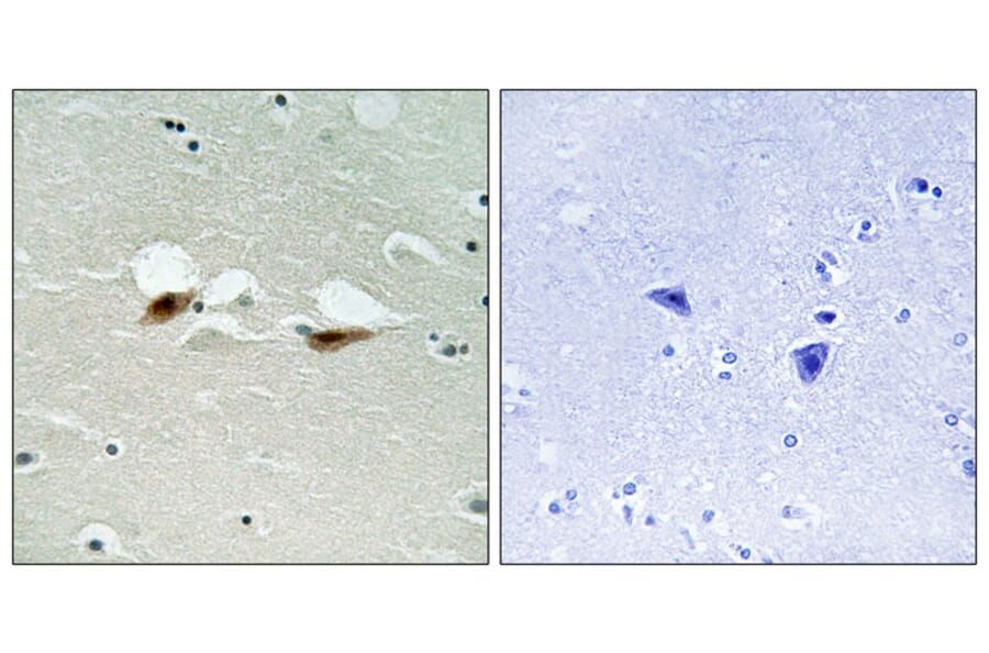 Immunohistochemistry - ATF-2 (Phospho-Ser472) Antibody from Signalway Antibody (11785) - Antibodies.com