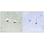 Immunohistochemistry - ATF-2 (Phospho-Ser472) Antibody from Signalway Antibody (11785) - Antibodies.com