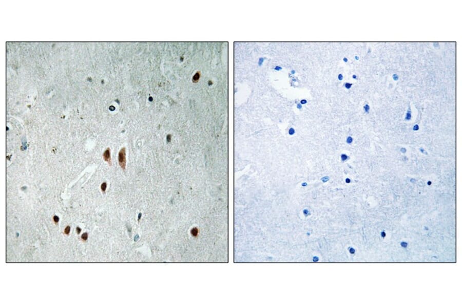 Immunohistochemistry - CNOT2 (Phospho-Ser101) Antibody from Signalway Antibody (11810) - Antibodies.com