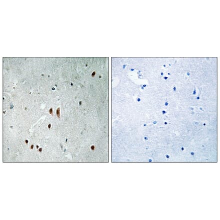 Immunohistochemistry - CNOT2 (Phospho-Ser101) Antibody from Signalway Antibody (11810) - Antibodies.com