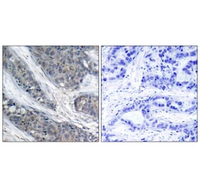Immunohistochemistry - IRS-1 (Phospho-Ser307) Antibody from Signalway Antibody (11235) - Antibodies.com