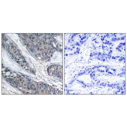 Immunohistochemistry - IRS-1 (Phospho-Ser307) Antibody from Signalway Antibody (11235) - Antibodies.com
