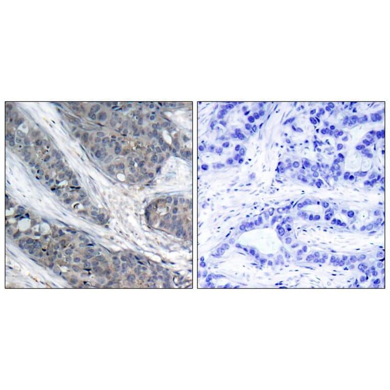 Immunohistochemistry - IRS-1 (Phospho-Ser307) Antibody from Signalway Antibody (11235) - Antibodies.com