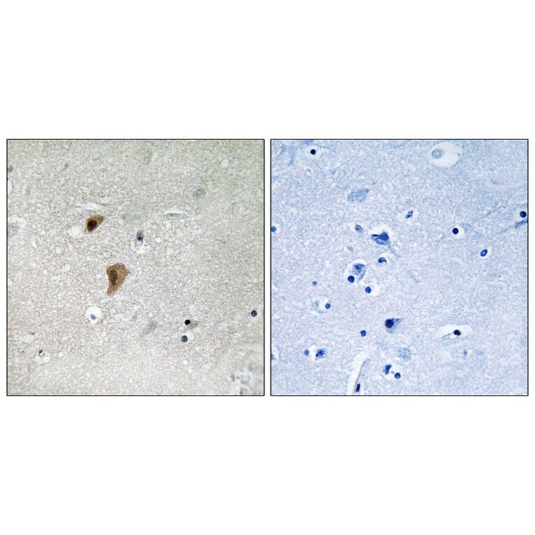 Immunohistochemistry - HSF1 (Phospho-Thr142) Antibody from Signalway Antibody (11715) - Antibodies.com