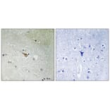 Immunohistochemistry - ALK (Phospho-Tyr1096) Antibody from Signalway Antibody (11726) - Antibodies.com