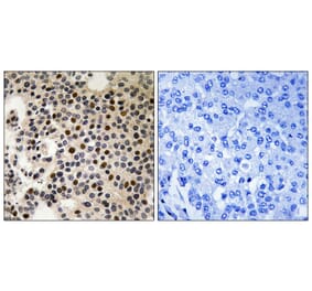 Immunohistochemistry - PAK2 (Phospho-Ser197) Antibody from Signalway Antibody (11749) - Antibodies.com