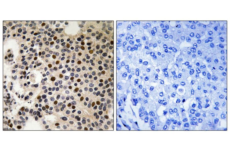 Immunohistochemistry - PAK2 (Phospho-Ser197) Antibody from Signalway Antibody (11749) - Antibodies.com