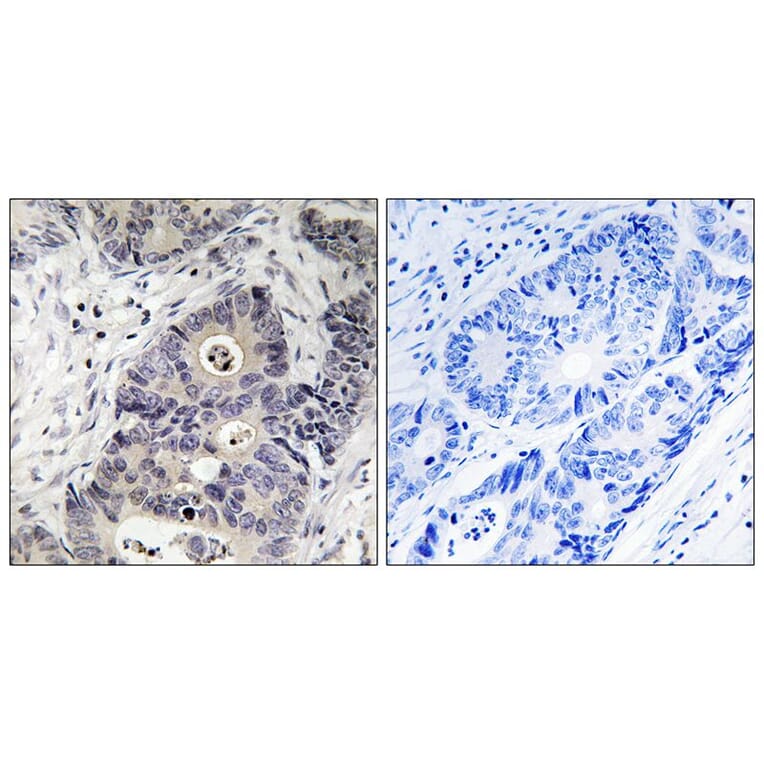 Immunohistochemistry - iNOS (Phospho-Tyr151) Antibody from Signalway Antibody (11766) - Antibodies.com