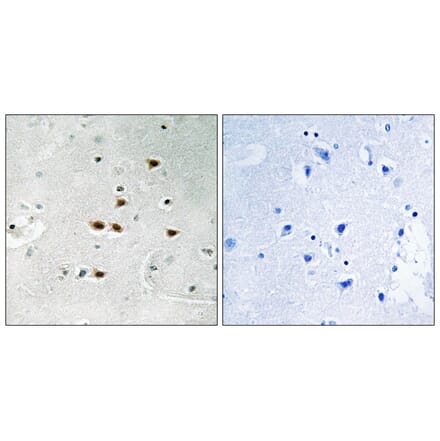 Immunohistochemistry - ITCH (Phospho-Tyr420) Antibody from Signalway Antibody (11774) - Antibodies.com