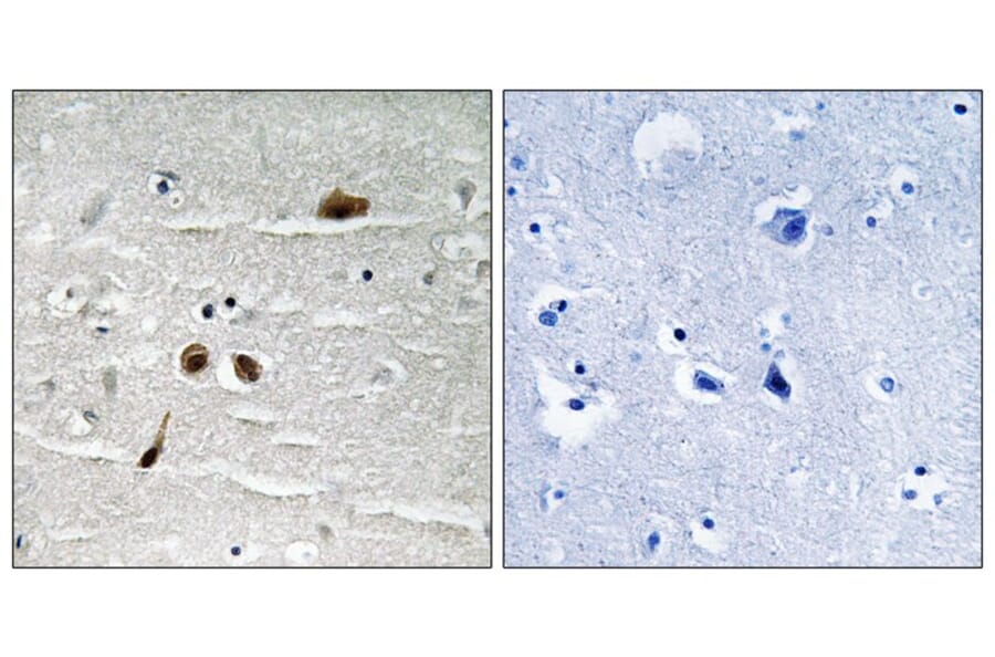 Immunohistochemistry - MDC1 (Phospho-Ser513) Antibody from Signalway Antibody (11807) - Antibodies.com