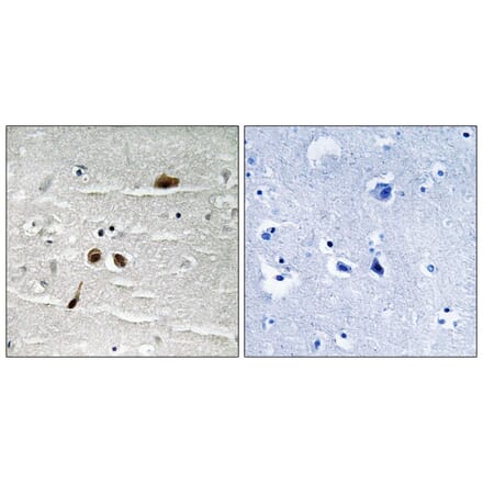 Immunohistochemistry - MDC1 (Phospho-Ser513) Antibody from Signalway Antibody (11807) - Antibodies.com