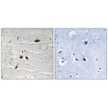 Immunohistochemistry - MDC1 (Phospho-Ser513) Antibody from Signalway Antibody (11807) - Antibodies.com