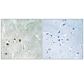 Immunohistochemistry - Tip60 (Phospho-Ser90) Antibody from Signalway Antibody (11815) - Antibodies.com