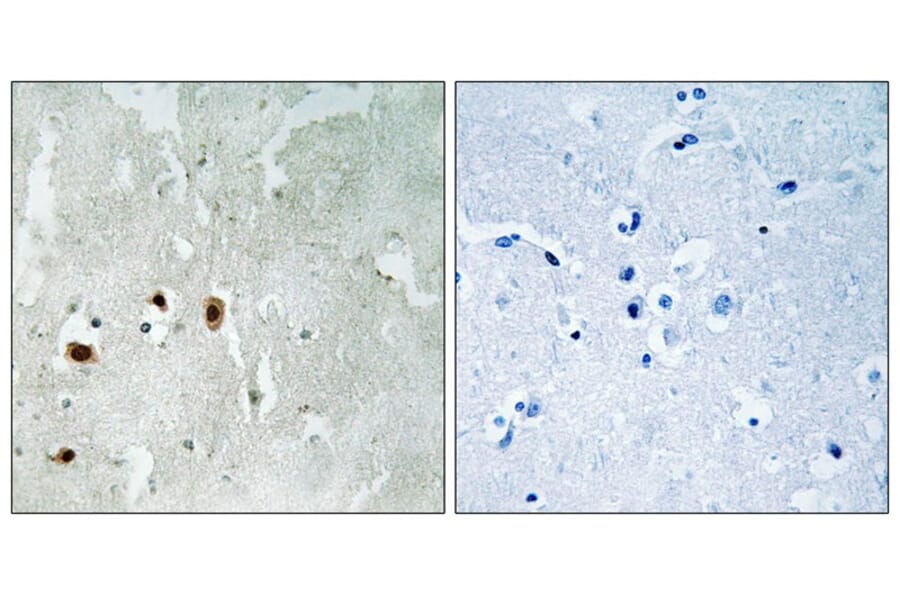 Immunohistochemistry - Tip60 (Phospho-Ser90) Antibody from Signalway Antibody (11815) - Antibodies.com