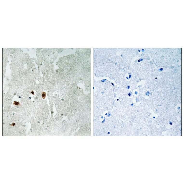 Immunohistochemistry - Tip60 (Phospho-Ser90) Antibody from Signalway Antibody (11815) - Antibodies.com