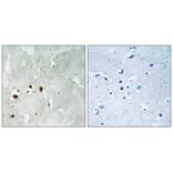 Immunohistochemistry - Tip60 (Phospho-Ser90) Antibody from Signalway Antibody (11815) - Antibodies.com