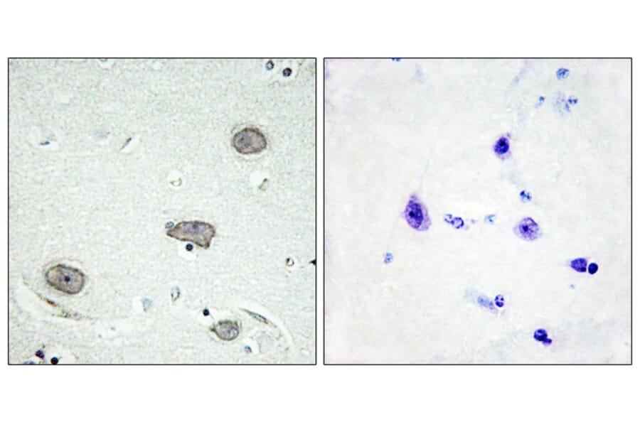 Immunohistochemistry - CSFR (Phospho-Tyr809) Antibody from Signalway Antibody (12135) - Antibodies.com