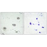 Immunohistochemistry - CSFR (Phospho-Tyr809) Antibody from Signalway Antibody (12135) - Antibodies.com