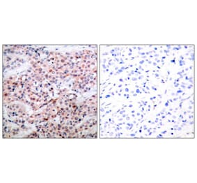 Immunohistochemistry - BCL-2 (Phospho-Thr56) Antibody from Signalway Antibody (11064) - Antibodies.com