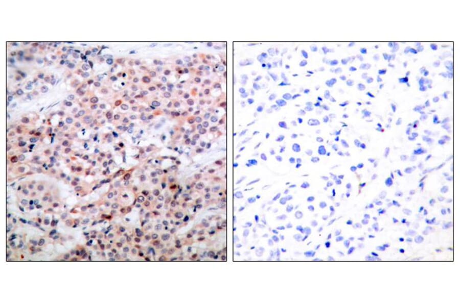 Immunohistochemistry - BCL-2 (Phospho-Thr56) Antibody from Signalway Antibody (11064) - Antibodies.com