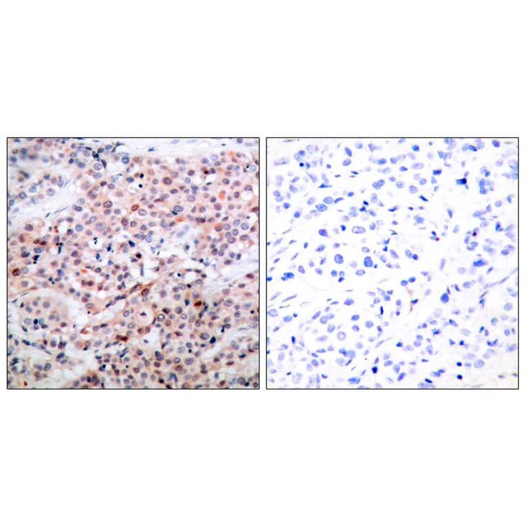 Immunohistochemistry - BCL-2 (Phospho-Thr56) Antibody from Signalway Antibody (11064) - Antibodies.com
